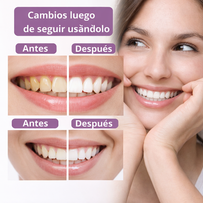 BlanCare Blanqueador Dental — Sonrisa perfecta al instante