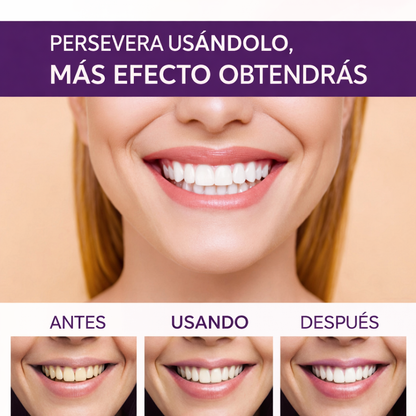 BlanCare Blanqueador Dental — Sonrisa perfecta al instante